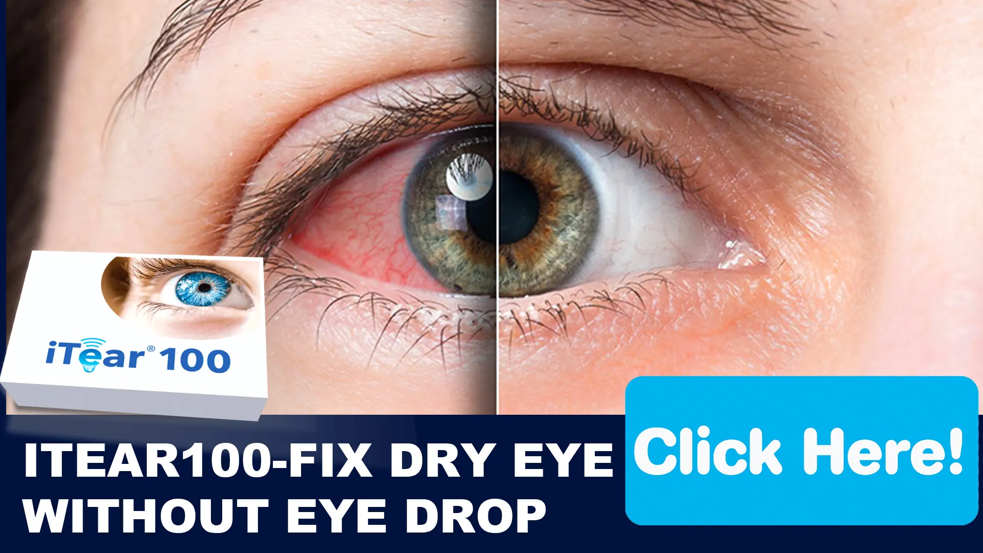 A Closer Look at Dry Eye: What Causes It?